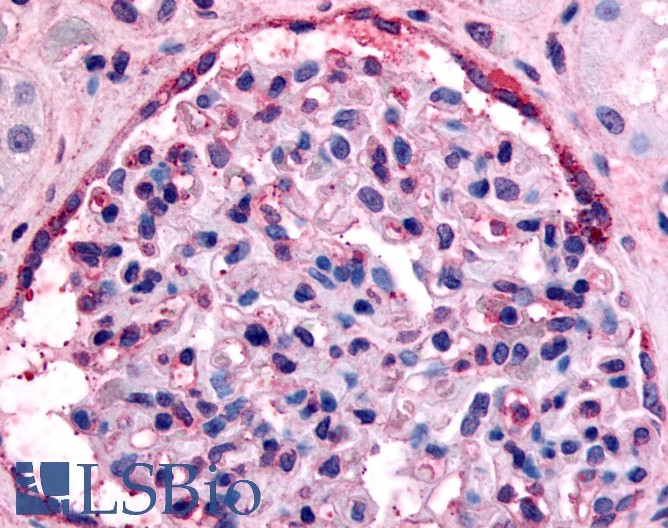 PathPlus™ Polyclonal Rabbit anti-Human EPHA4 / EPH Receptor A4 Antibody (C-Terminus, IHC)