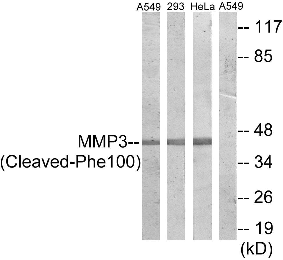 Polyclonal Rabbit anti-Human MMP3 Antibody (Cleaved-Phe100, WB)