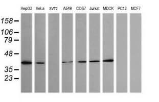 Monoclonal Mouse anti-Human MAP2K3 / MEK3 / MKK3 Antibody (clone OTI2G3, IF, WB)