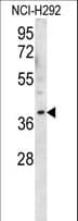 Polyclonal Rabbit anti-Human OR2AK2 Antibody (aa259-287, WB)