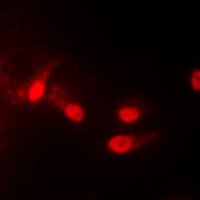 Polyclonal Rabbit anti-Human CSNK1E / CK1 Epsilon Antibody (Internal, IHC, IF, WB)