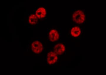 SMAD1 Antibody (phospho-Ser465)