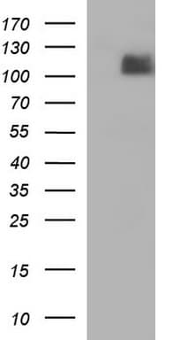 Monoclonal Mouse anti-Human ITGB6 / Integrin Beta 6 Antibody (clone OTI1D2, WB)