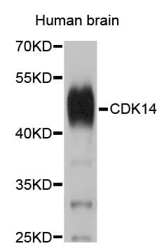 PFTK1 / CDK14 Antibody