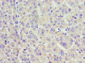 Polyclonal Rabbit anti-Human ACP1 / Acid Phosphatase Antibody (aa1-158, IHC, WB)