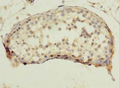 QTRT1 Antibody