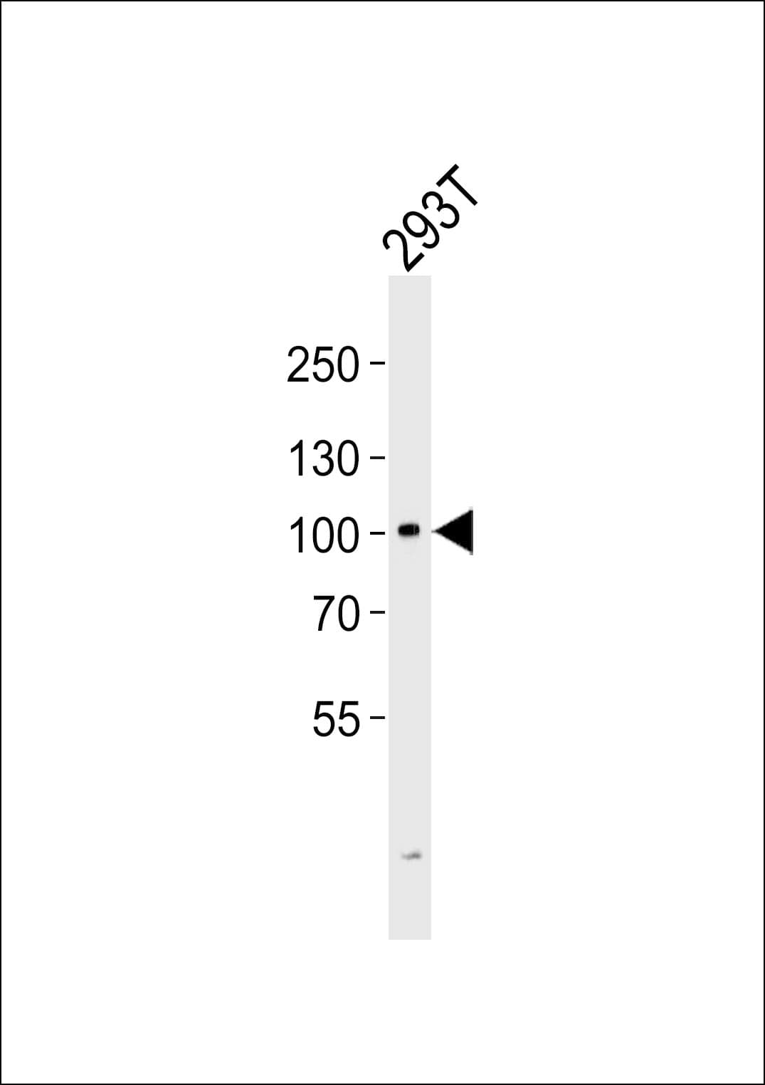 Polyclonal Rabbit anti-Human GIT2 Antibody (aa714-749, WB)