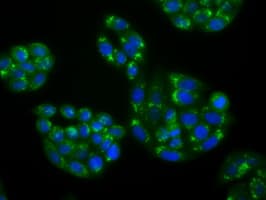 Monoclonal Mouse anti-Human NPR3 Antibody (clone OTI11B6, IHC, IF, WB)