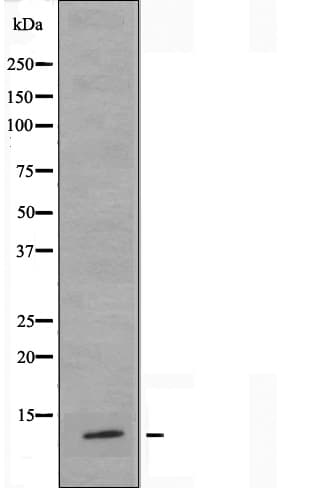 Polyclonal Rabbit anti-Human RPL36 / Ribosomal Protein L36 Antibody (IHC, IF, WB)