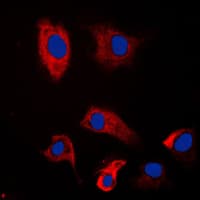 PSMD2 Antibody (N-Terminus)