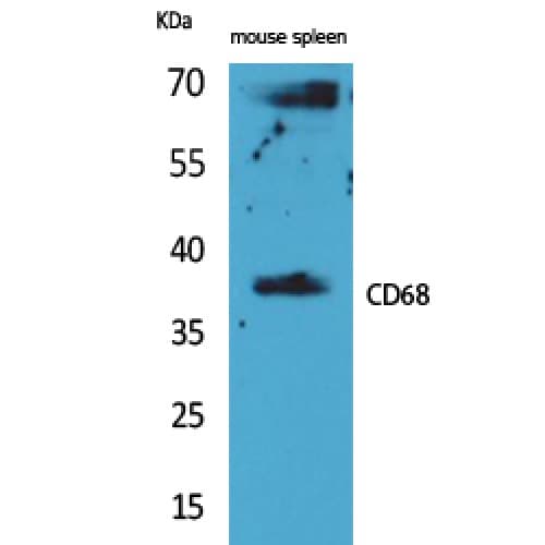 Polyclonal Rabbit anti-Human CD68 Antibody (171-220 aa, Internal, WB)