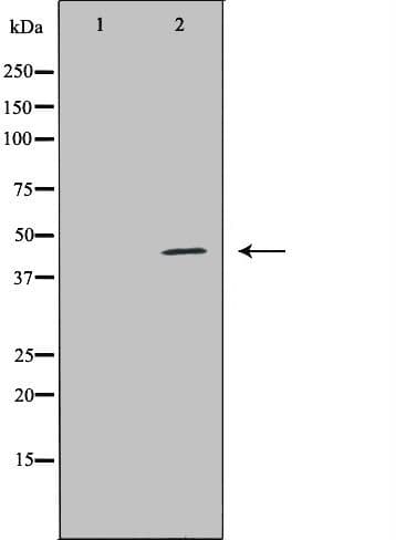 SPHK / SPHK1 Antibody