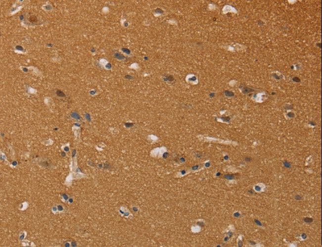 Polyclonal Rabbit anti-Human CHRNA4 / NACHR Antibody (IHC)
