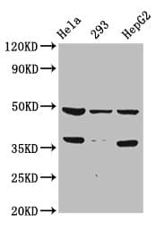 Polyclonal Rabbit anti-Human SOX4 Antibody (aa1-60, IHC, WB)