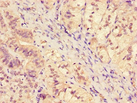 SGK1 / SGK Antibody