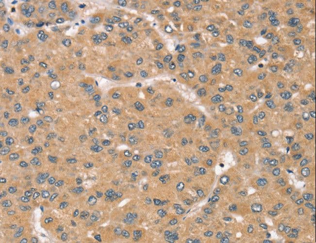 RBM38 Antibody