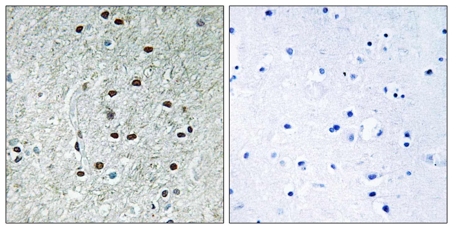 REXO1 / REX1 Antibody (aa185-234)