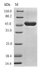 Human TRIAP1 Protein (Recombinant GST, N-terminus)