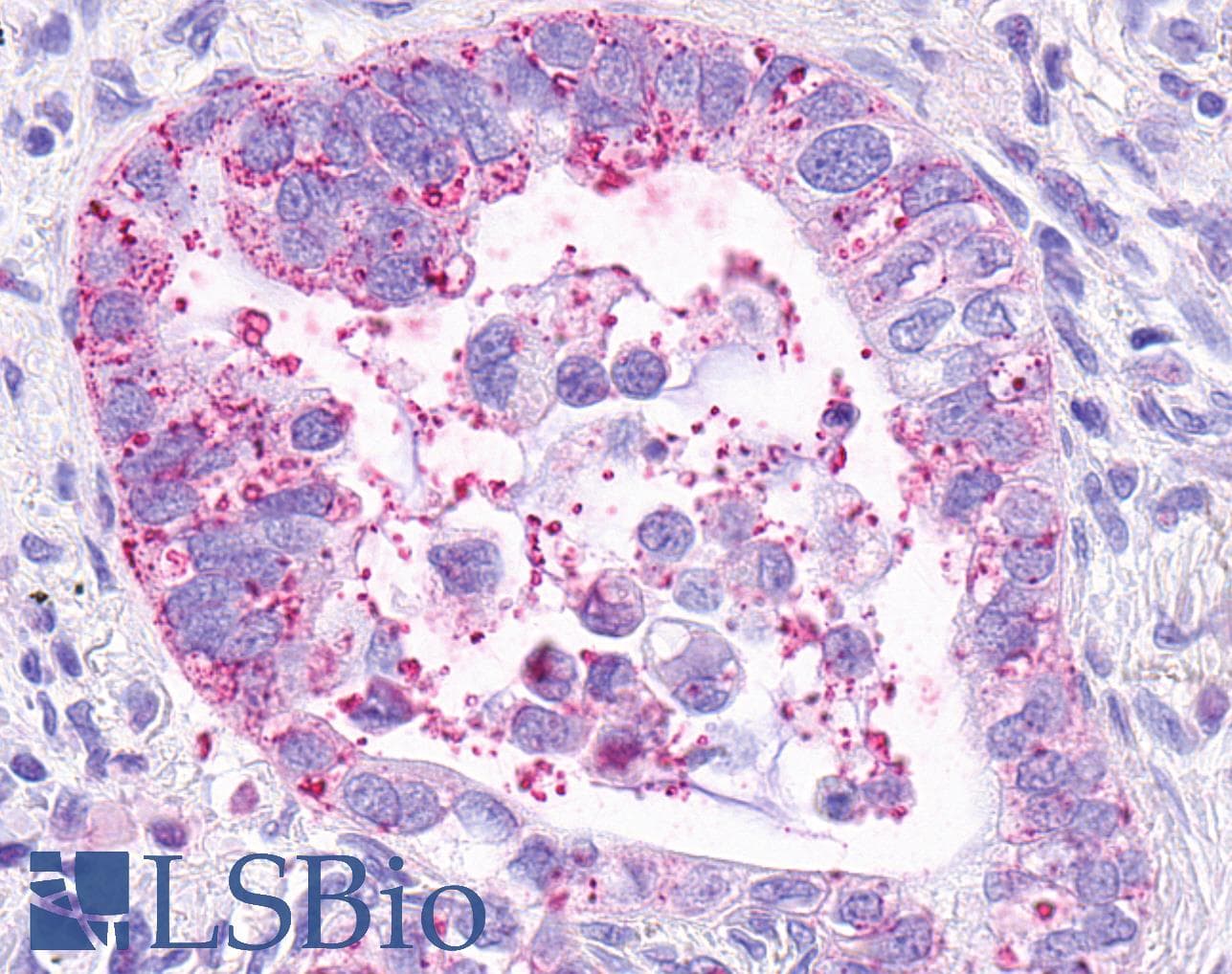 IHC-plus™ MRGPRX3 / MRGX3 Antibody (Extracellular Domain)