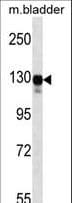 MAP3K6 / MEKK6 Antibody (aa223-252)
