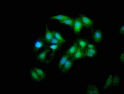 Polyclonal Rabbit anti-Human MOB1A Antibody (aa2-216, IHC, WB)