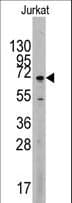 MAPK4 / ERK4 Antibody (aa537-566)