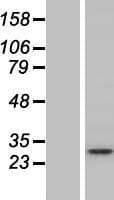STX12 / Syntaxin 12 Protein (Over-Expression Lysate Myc-DDK (Flag))