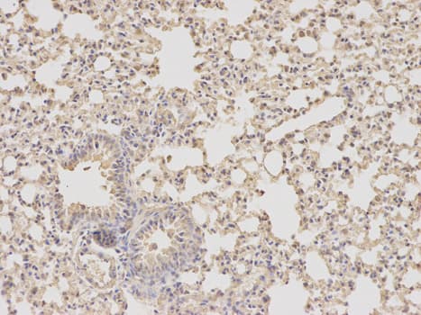 IHC-plus™ DHFR Antibody