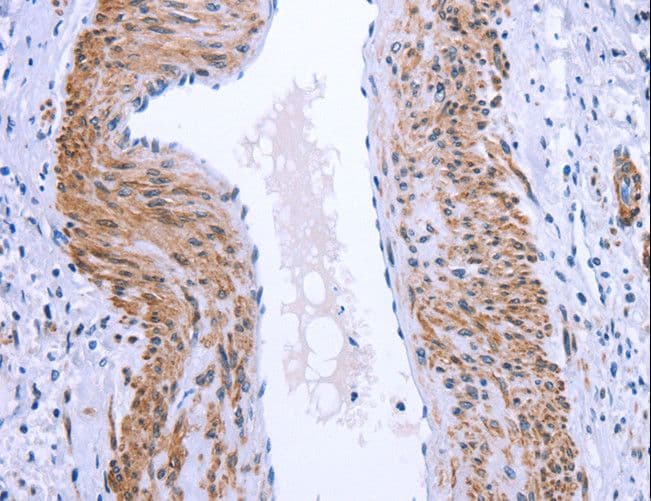 GPR171 Antibody