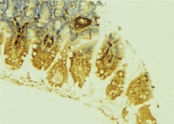LPGAT1 Antibody