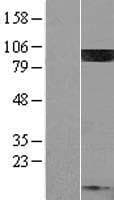 PIP5K1C Protein (Over-Expression Lysate Myc-DDK (Flag))