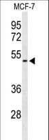 FLVCR2 Antibody (aa478-507)