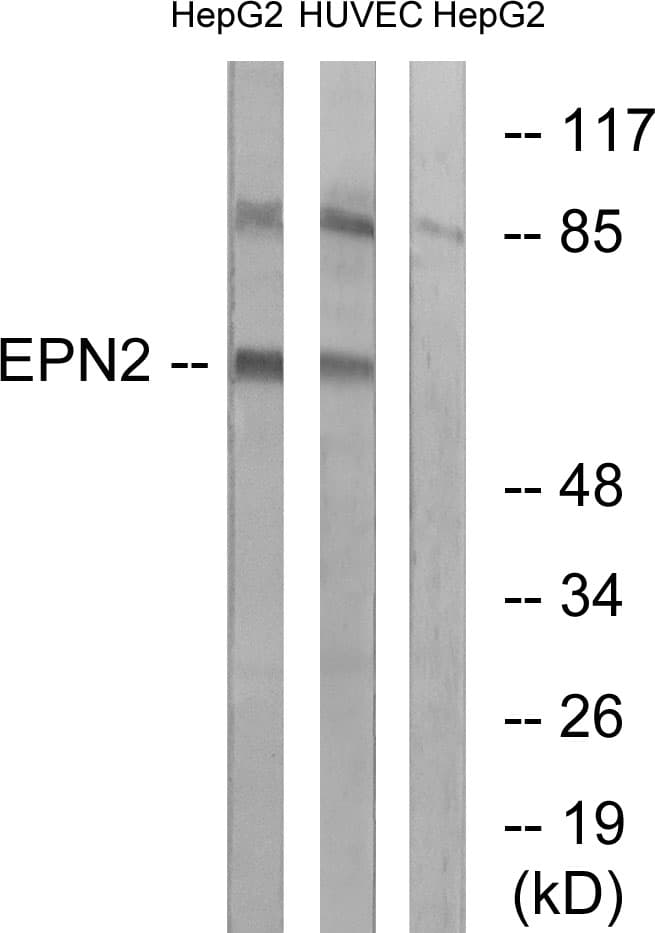 Polyclonal Rabbit anti-Human EPN2 Antibody (aa271-320, WB)