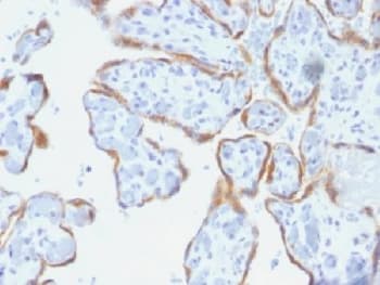 Monoclonal Mouse anti-Human TIMP2 Antibody (clone SPM356, Azide-free,BSA-free, IHC, IF, WB)