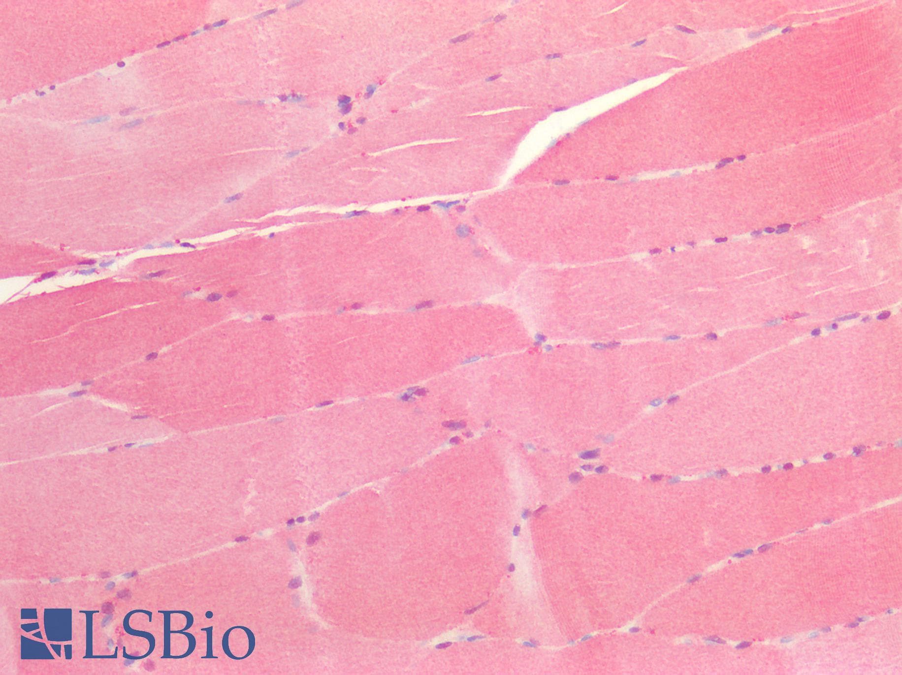 IHC-plus™ PRDX6 / Peroxiredoxin 6 Antibody (aa15-27)