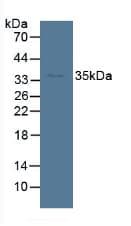 SORD / Sorbitol Dehydrogenase Antibody (aa98-355)