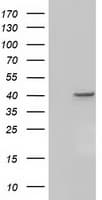 ACAT2 Antibody (clone OTI3A8)