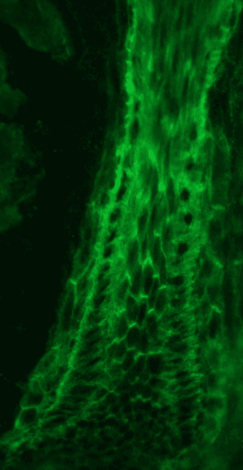 IHC-plus™ PKP3 / Plakophilin 3 Antibody (clone 23E3/4)