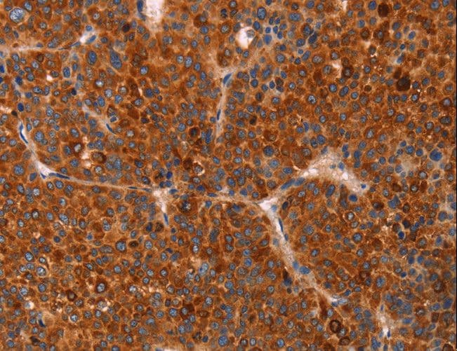GC / Vitamin D-Binding Protein Antibody