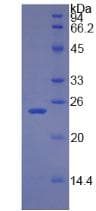 Human RBP4 Protein (Recombinant His, N-Terminal)