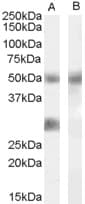 Polyclonal Goat anti-Human IGFBP3 Antibody (aa191-205, WB)
