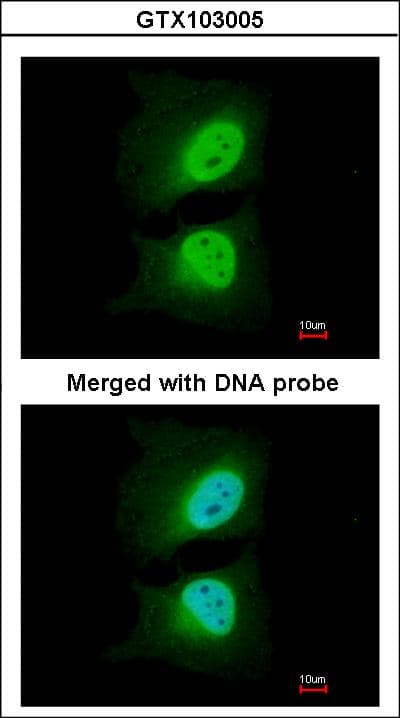 Polyclonal Rabbit anti-Human CSE1L Antibody (aa222-469, IHC, WB)