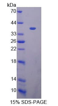 Human BCAS3 Protein (Recombinant His-T7)