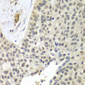 Polyclonal Rabbit anti-Human SNRPD2 Antibody (IHC, IF, WB)