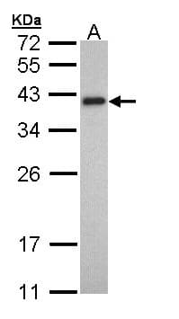 TPM2 Antibody (aa1-234)