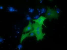 PRKD2 / PKD2 Antibody (clone OTI2E2)