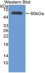 DIO2 Antibody (aa30-259)