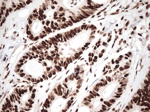 TRIM28 / KAP1 Antibody (clone OTI5E10, Carrier-free)