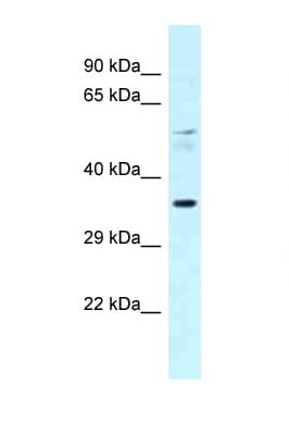 PPARA / PPAR Alpha Antibody (C-Terminus)