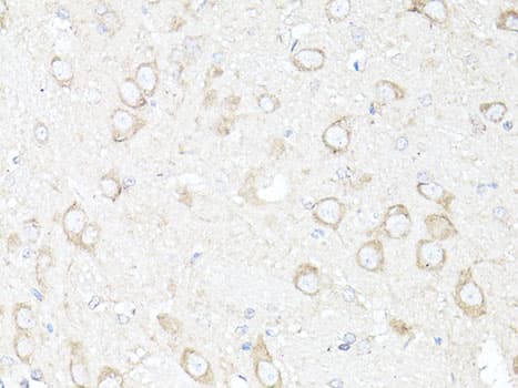 Polyclonal Rabbit anti-Human MAP1LC3B / LC3B Antibody (IHC, IF, WB)